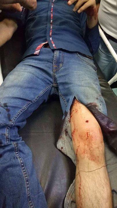 Nine people injured in Erbil following the El Clasico match, Kurdistan Region, April 24, 2017. (Photo: Social Media)